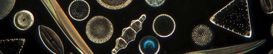 WebPersönliches2 Mikroskopfotografie diverse Kieselalgen Fokus Ergebnis 1 (B, 12, 9).jpg